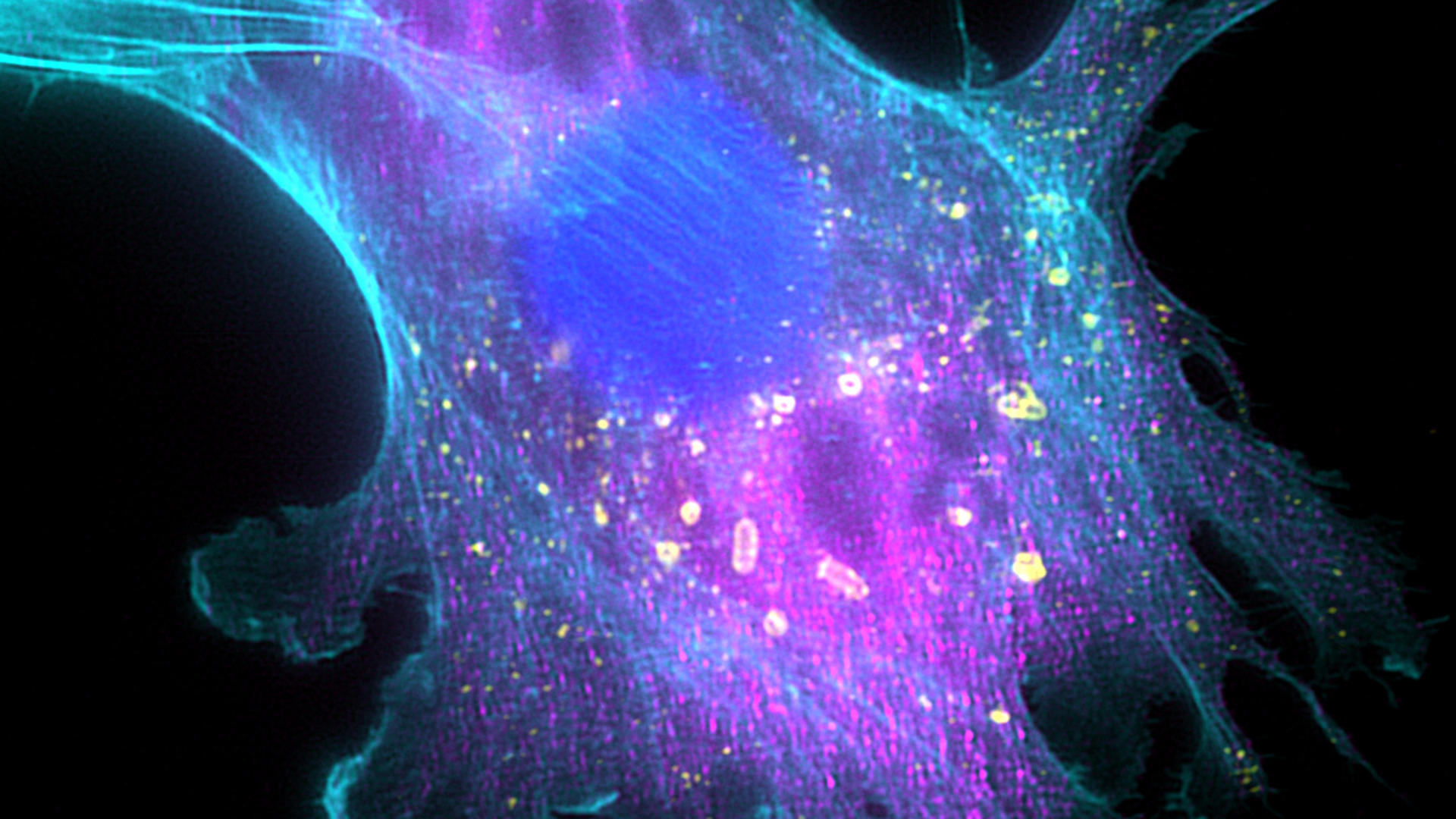 Engineered salmonella inside a cancer cell