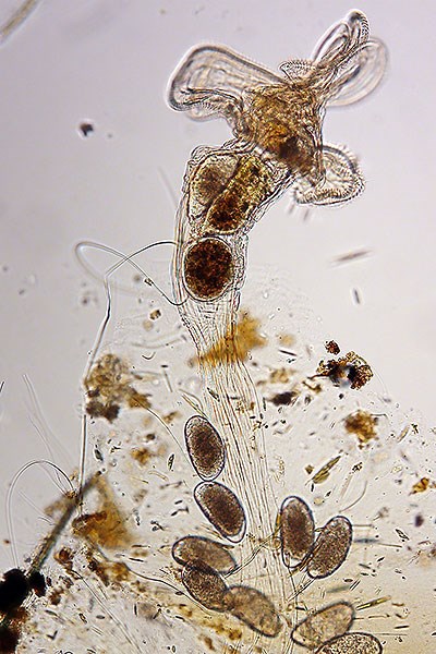 A microscope view of an Octotrocha rotifer.