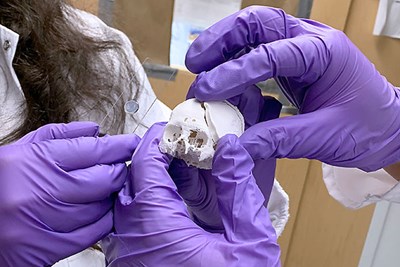 Suvarnapathaki and Wu examine a skull defect on a miniature plastic model and discuss how the hydrogel scaffold could be implanted to repair it.