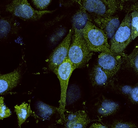 Green dots show protein in chemical modification; cell's nucleus is blue. 