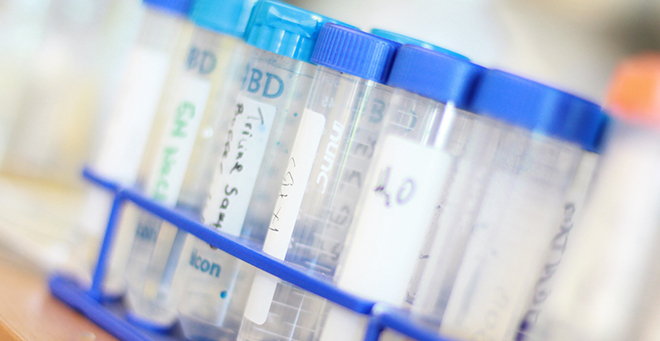 Close up of vials in a lab